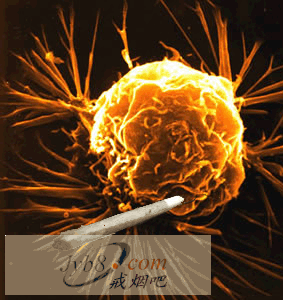 吸烟招致癌症细胞 