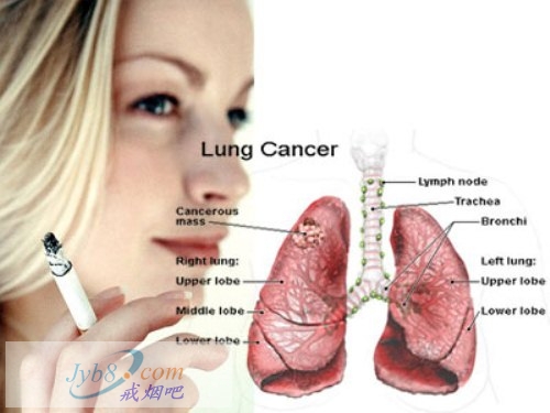 吸烟是肺癌的主因